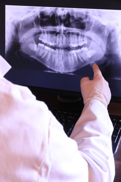 Best Emergency Dentist for Lost Fillings or Crowns in Conway, PA